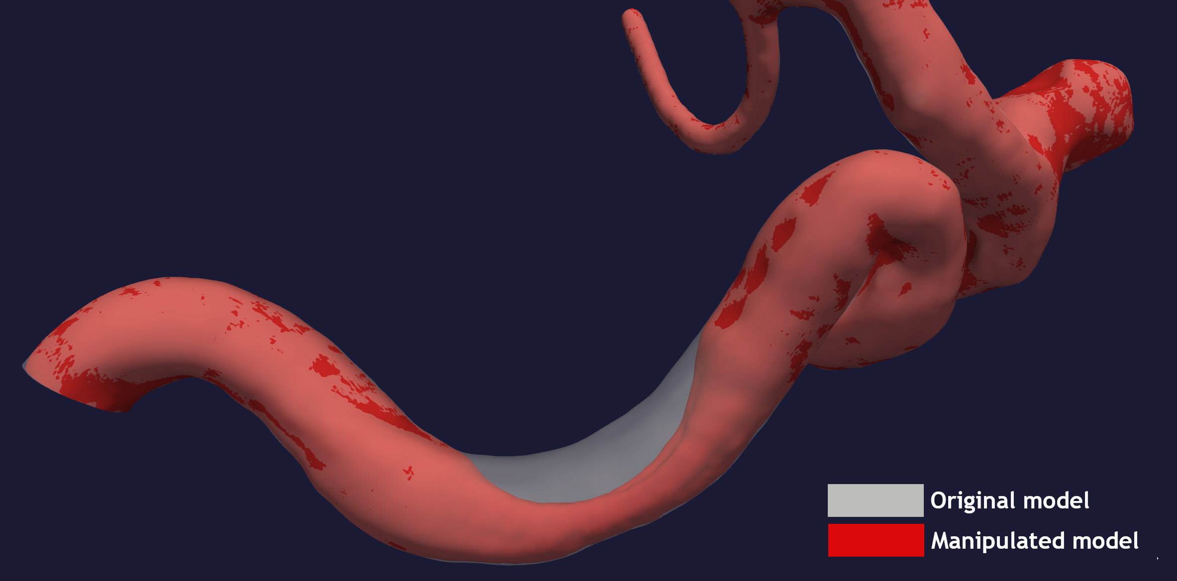 _images/asymmetric_stenosis.png