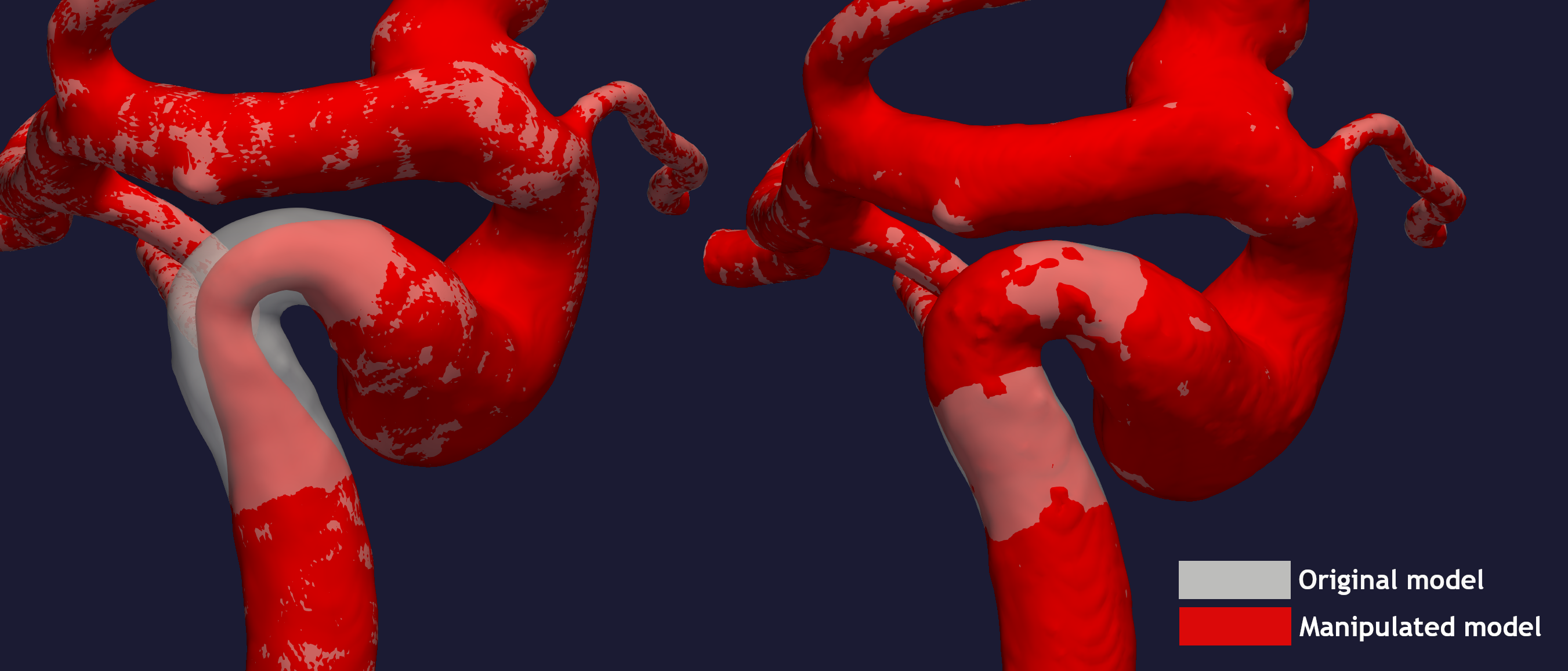 _images/fix_stenosis.png