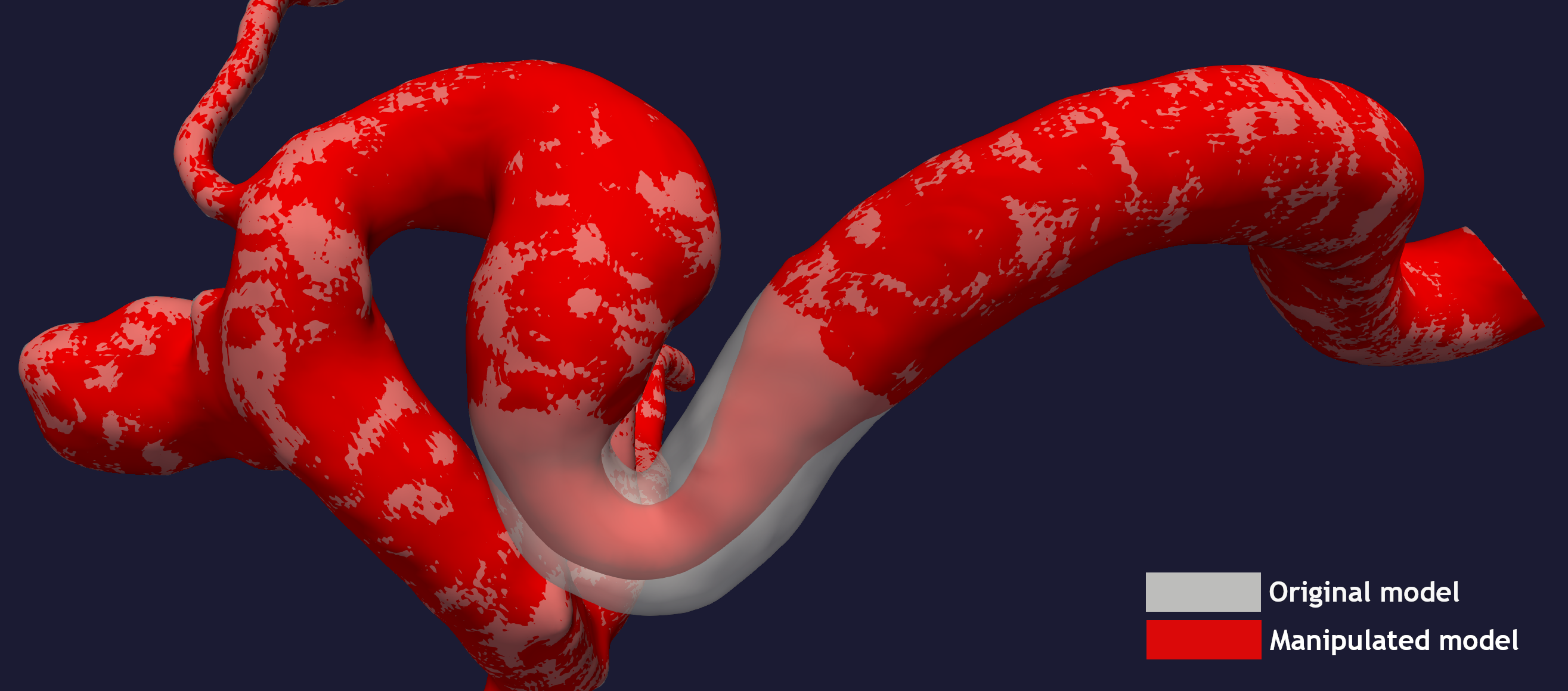 _images/make_stenosis.png