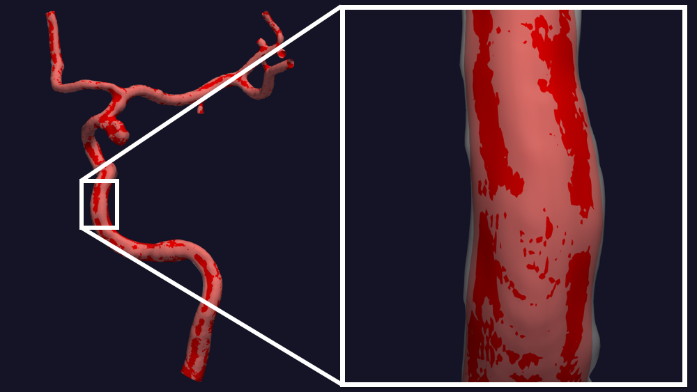 _images/manipulate_surface_smooth.png